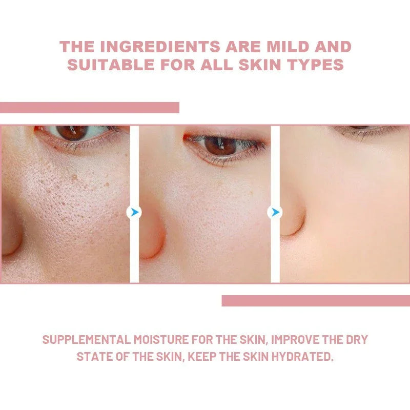 Korean Peach 70% Niacinamide Facial Serum,Face Brightening Hydrating Moisturizing Lotion,Skin Care Essence Fade Dullness Melasma