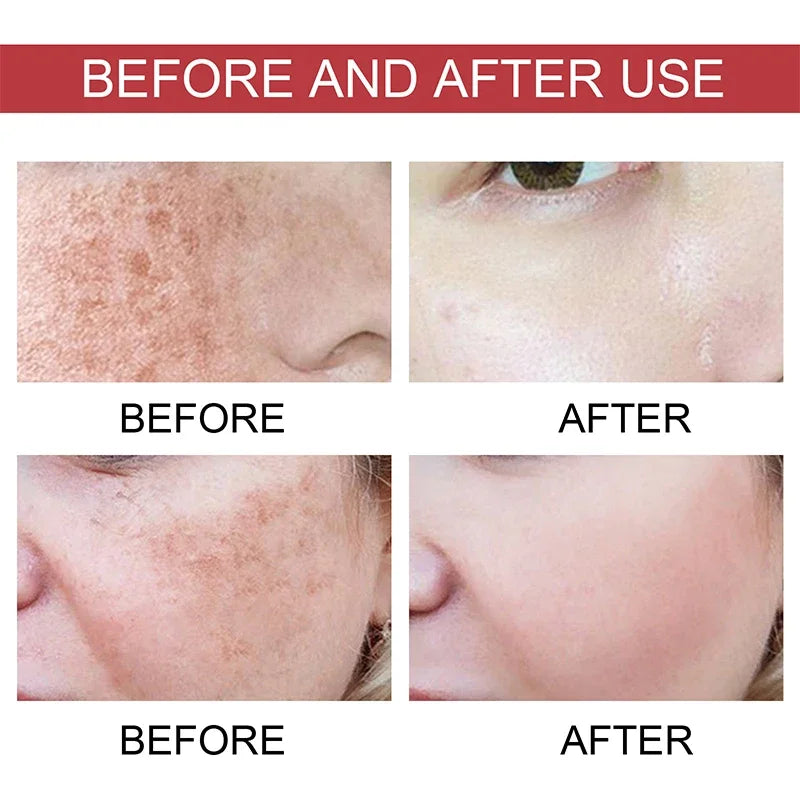 Korean Peach 70% Niacinamide Facial Serum,Face Brightening Hydrating Moisturizing Lotion,Skin Care Essence Fade Dullness Melasma