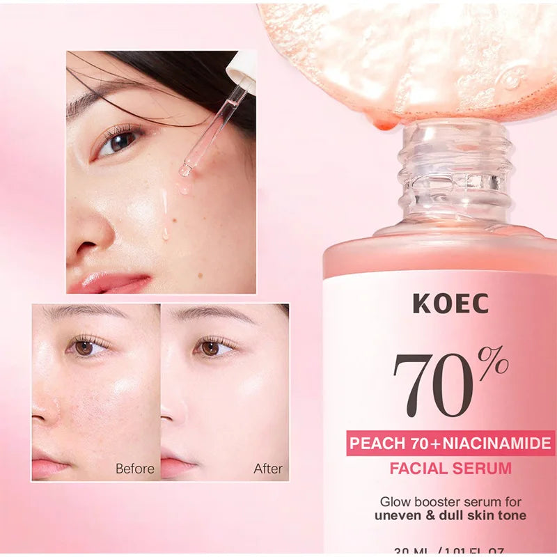 Korean Peach 70% Niacinamide Facial Serum,Face Brightening Hydrating Moisturizing Lotion,Skin Care Essence Fade Dullness Melasma