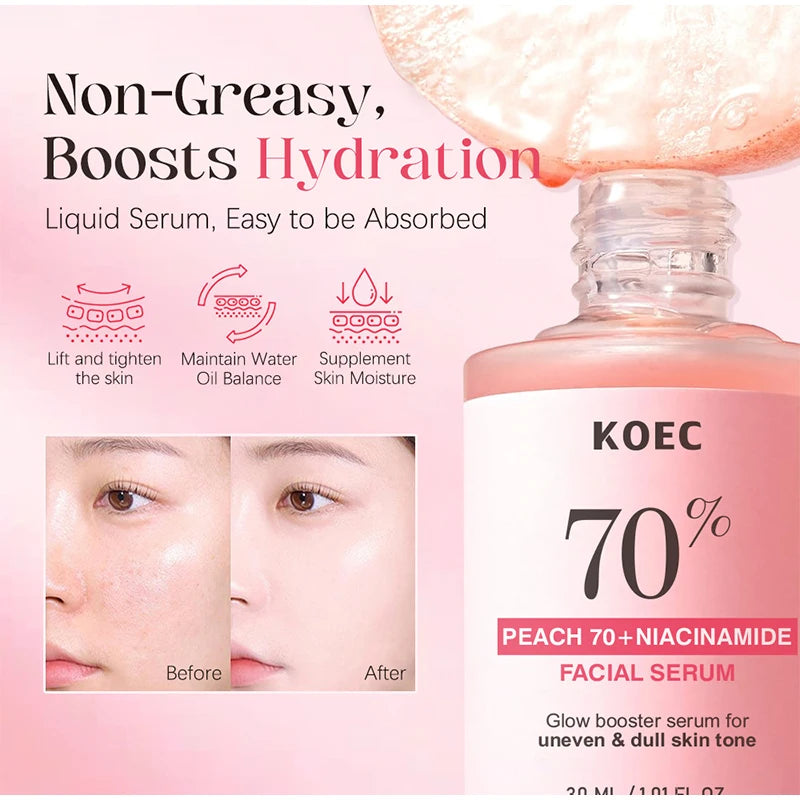Korean Peach 70% Niacinamide Facial Serum,Face Brightening Hydrating Moisturizing Lotion,Skin Care Essence Fade Dullness Melasma