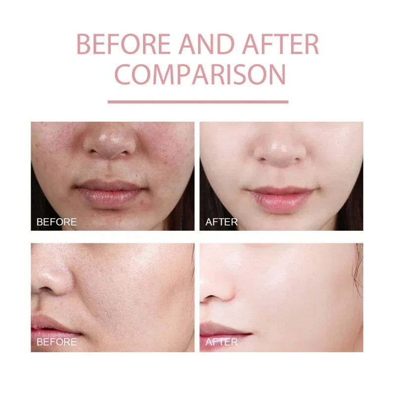 Korean Peach 70% Niacinamide Facial Serum,Face Brightening Hydrating Moisturizing Lotion,Skin Care Essence Fade Dullness Melasma