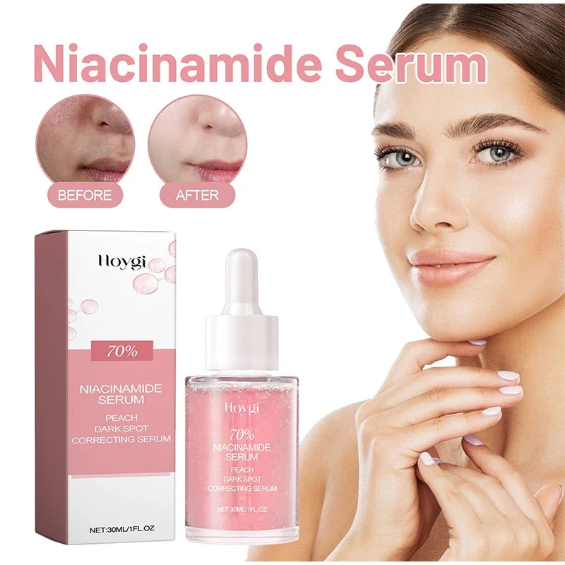 Korean Peach 70% Niacinamide Facial Serum,Face Brightening Hydrating Moisturizing Lotion,Skin Care Essence Fade Dullness Melasma
