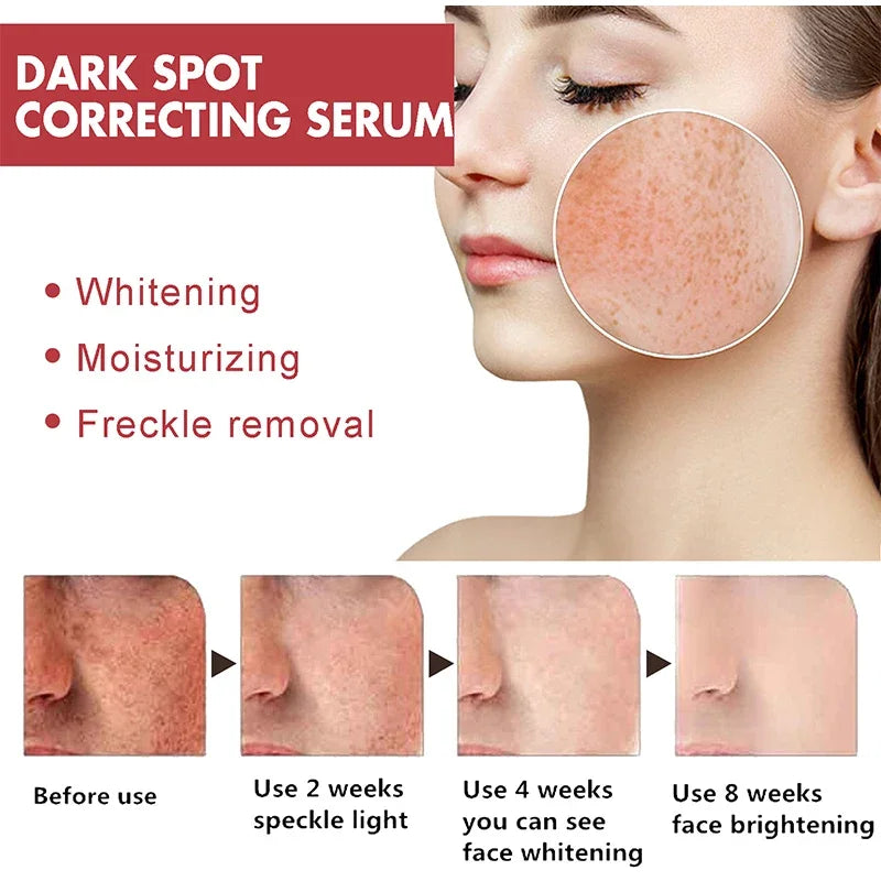 Korean Peach 70% Niacinamide Facial Serum,Face Brightening Hydrating Moisturizing Lotion,Skin Care Essence Fade Dullness Melasma